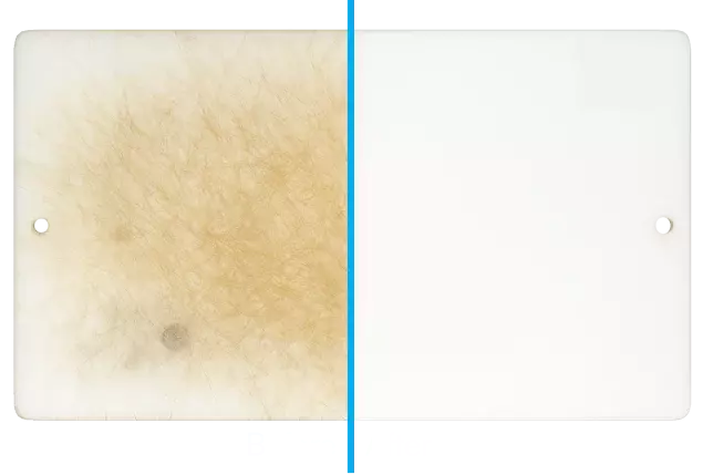 before after before after